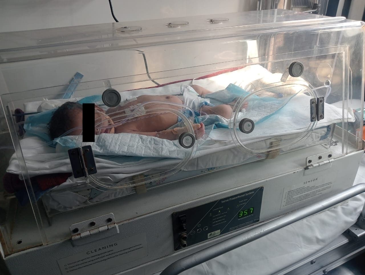 Premature Baby Shifted From Malhotra Mother & Child Hospital, Panipat to Indraprastha Apollo Hospital, Delhi